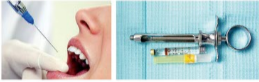胰島素，牙科麻醉6.png